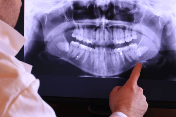 Best Emergency Broken Tooth Repair in St Louis, MO