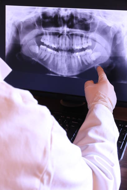 Best Emergency Treatment for Toothache in St Louis, MO
