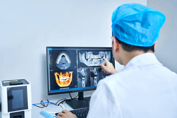 Best Emergency Tooth Extraction in St Louis, MO